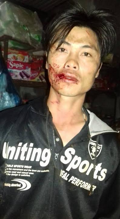 Anh Nguyễn Thanh Sang với vết thương bị sau khi bị đánh hội đồng (ảnh; Facebook Thanh Sang Ths)