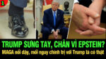 VL1-18.07: Trump sưng tay, sưng chân vì Jeffrey Epstein?