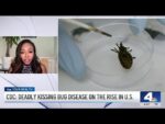 BỆNH MỚI CHẾT NGƯỜI Ở MỸ “KISSING BUG” (BỌ HÔN)!