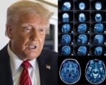 Newsom chế giễu Trump về kết quả chụp MRI ‘hoàn toàn bình thường’