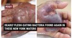 Vi khuẩn ăn thịt người được tìm thấy trong vùng nước ở New York