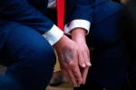Tổng thống Trump chuẩn bị tới bệnh viện Walter Reed kiểm tra sức khỏe lần thứ ba trong nhiệm kỳ hai