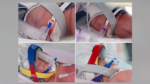 Tỷ lệ 1/15 triệu: Người phụ nữ sinh tư 4 bé gái đồng trứng tự nhiên